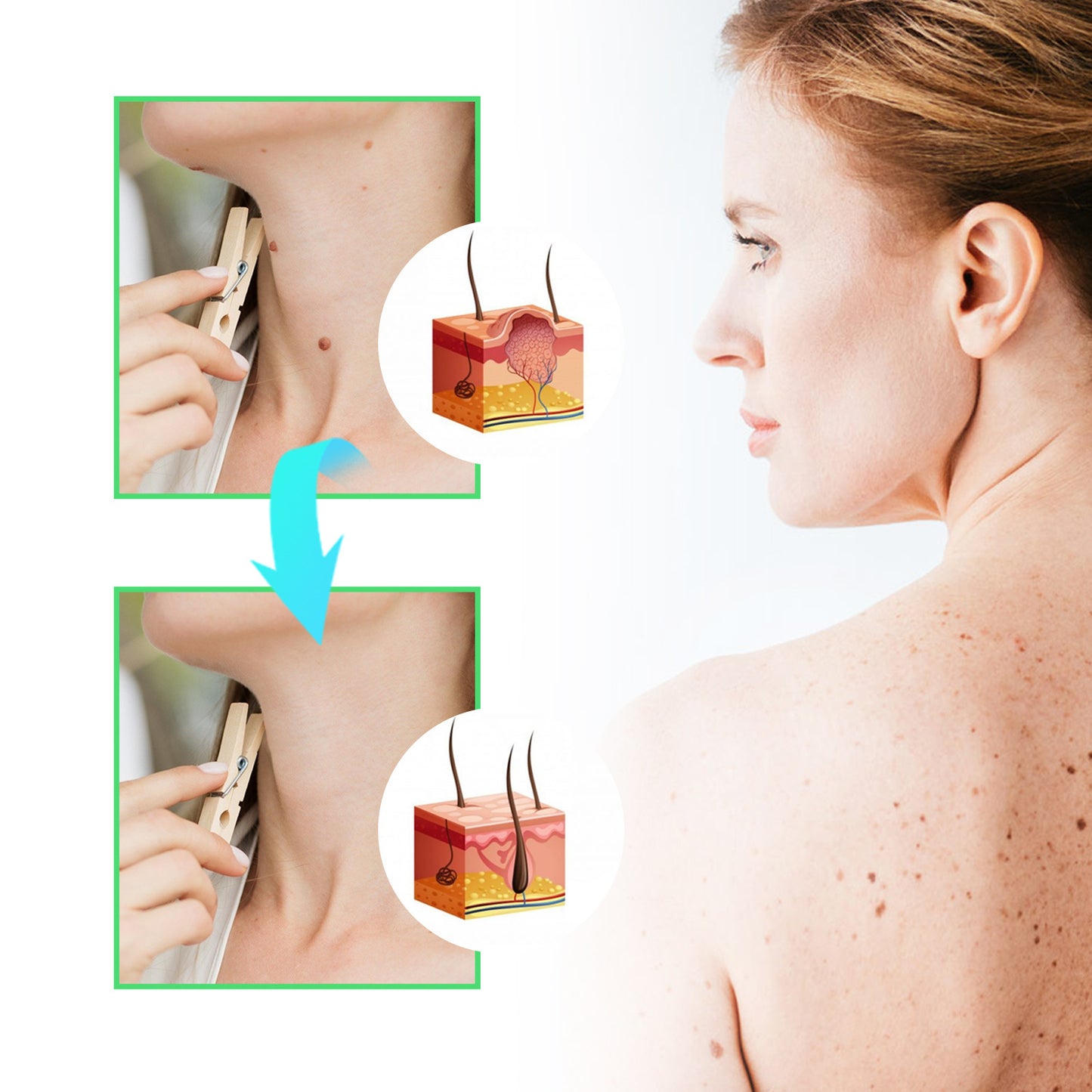 Facial Neck Body Skin Cleaning Care Wart Soap