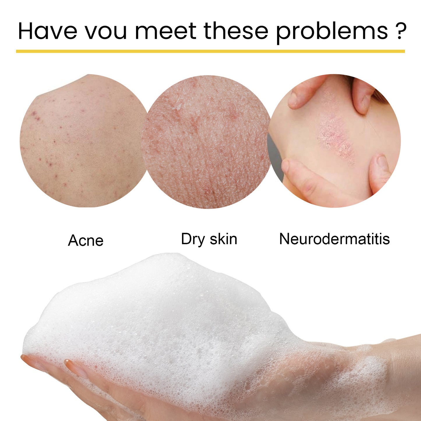 Deep Skin Cleaning Desalting PIMPLE Acne Tender And Smooth Skin Beauty Propolis Bath Soap