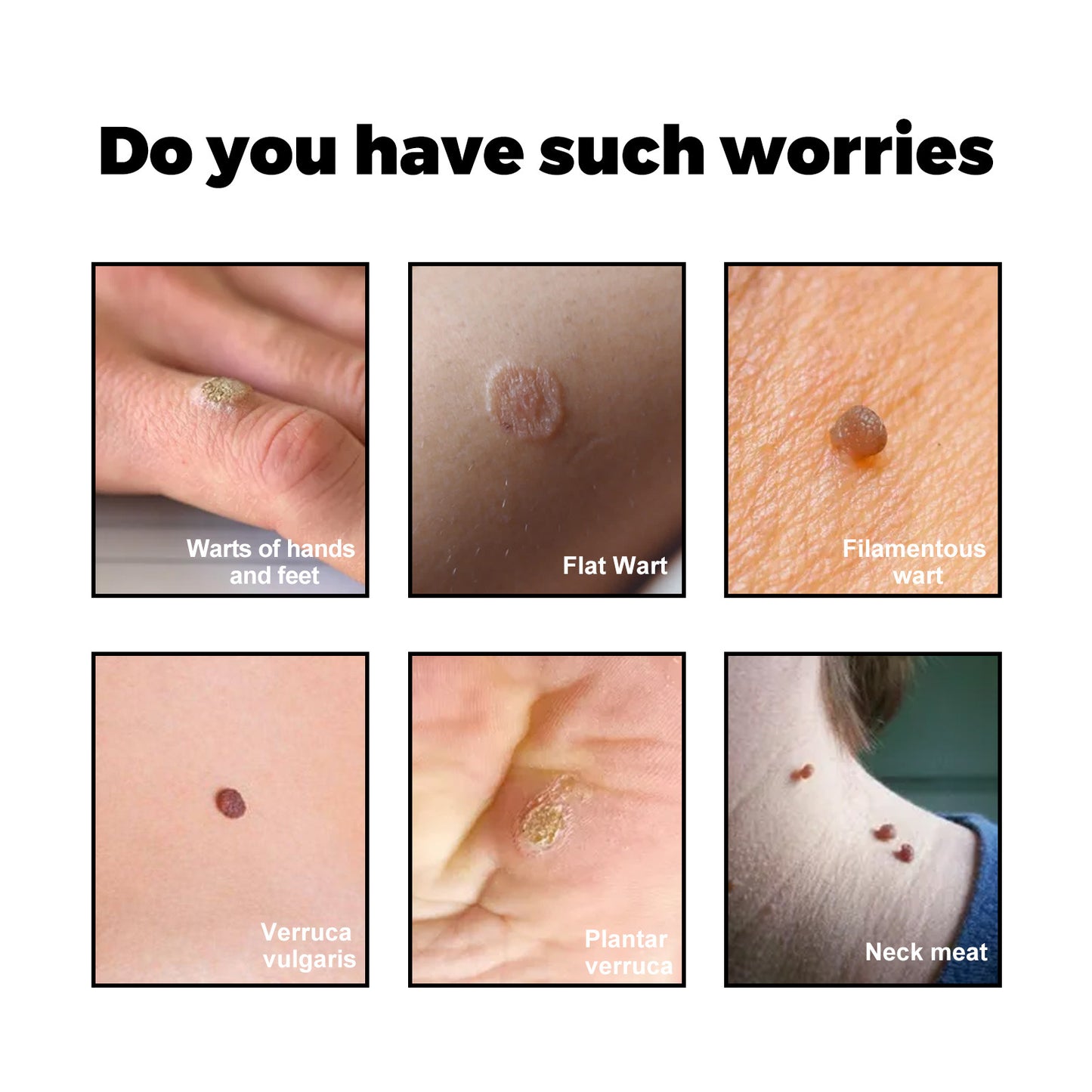 Facial Neck Body Skin Cleaning Care Wart Soap