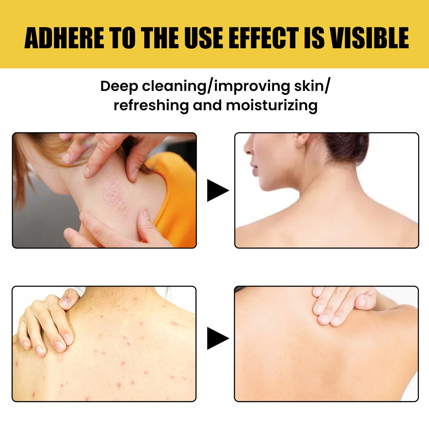 Deep Skin Cleaning Desalting PIMPLE Acne Tender And Smooth Skin Beauty Propolis Bath Soap